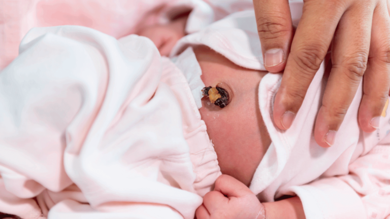 Cuidados esenciales: Aprende cómo cuidar el ombligo del recién nacido