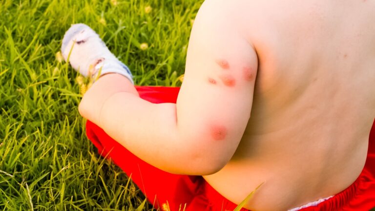 Protección infalible: Consejos para mantener a tu bebé alejado de los insectos en verano